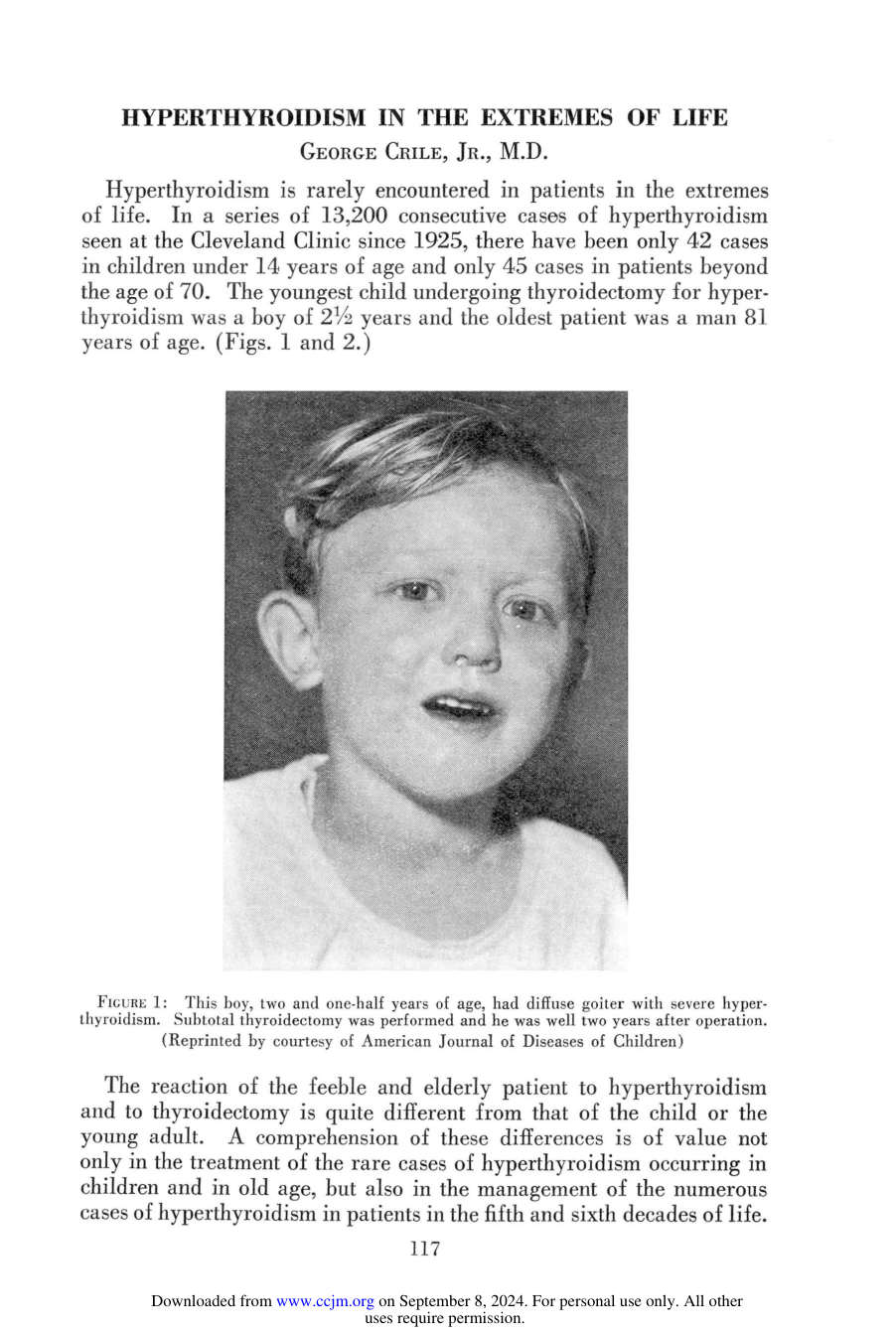 Cover for Hyperthyroidism In The Extremes Of Life